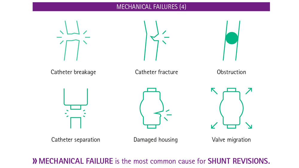 Infográfico sobre falhas mecânicas em derivações para hidrocefalia
