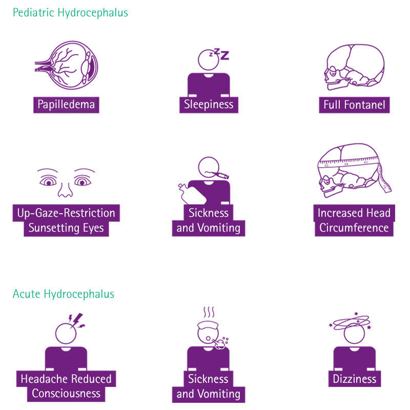 Ícones para os sintomas da hidrocefalia pediátrica e aguda
