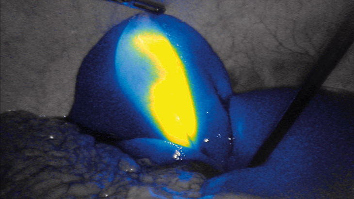 Intensidade da FI – Tecnologia de imagem por fluorescência 3D