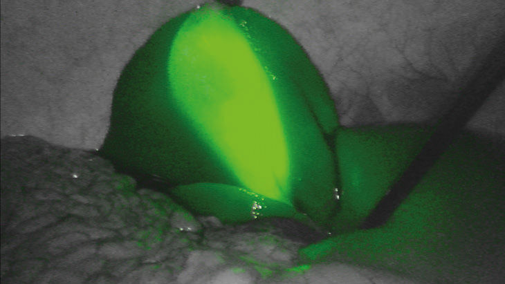 FI verde – Tecnologia de imagem por fluorescência 3D