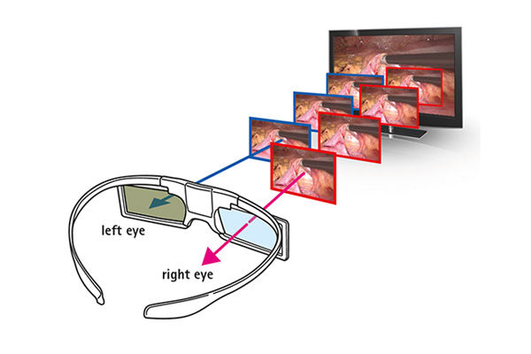 Exemplo de óculos 3D com obturador ativo