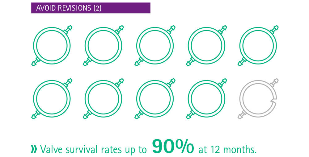 Infográfico: evite revisões